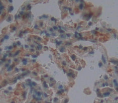 WB Image