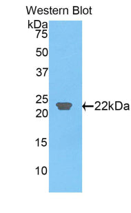 C-Type Lectin Domain Family 3, Member B (CLEC3B) Polyclonal Antibody - image 3
