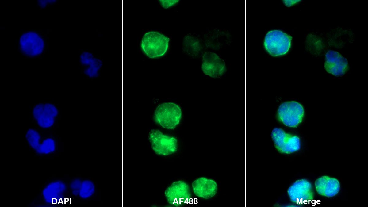 Tyrosine Kinase 2 (Tyk2) Monoclonal Antibody - image 2