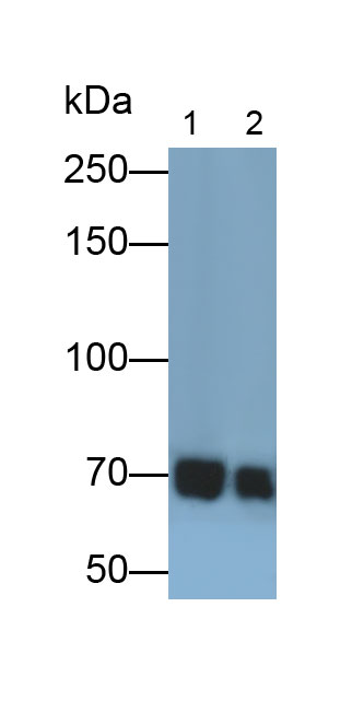 Tyrosine Kinase, Non Receptor 2 (TNK2) Polyclonal Antibody - image 2