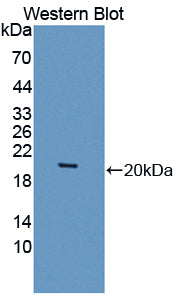 Western Blot; Samples: Lane1: Human Platelet lysate; Lane2: SH-SY5Y cell lysate; Lane3: HCT116 cell lysate; Primary Ab: 0.2ug/ml Rabbit Anti-Human SEPT6 Antibody; Second Ab: 0.2ug/ml HRP-Linked Caprine Anti-Rabbit IgG Polyclonal Antibody