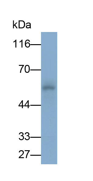 Cytochrome P450 2E1 (CYP2E1) Polyclonal Antibody - image 3