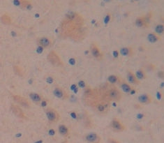 WB Image
