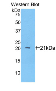 A Disintegrin And Metalloproteinase With Thrombospondin 12 (ADAMTS12) Polyclonal Antibody - image 3