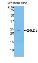 Western Blot; Sample: Lane1: Rat Skeletal Muscle Tissue; Lane2: Rat Heart Tissue; Lane3: Porcine Skeletal Muscle Tissue; Lane4: Porcine Heart Tissue.
