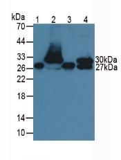 Troponin I Type 1, Slow Skeletal (TNNI1) Monoclonal Antibody - image 3