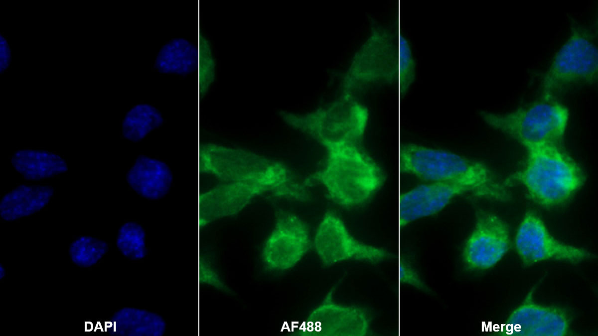 Western Blot; Sample: Lane1: Mouse Liver lysate; Lane2: Rat Liver lysate; Lane3: Rat Skeletal muscle lysate Primary Ab: 0.2ug/ml Rabbit Anti-Mouse ALT Antibody Second Ab: 0.2ug/mL HRP-Linked Caprine Anti-Rabbit IgG Polyclonal Antibody