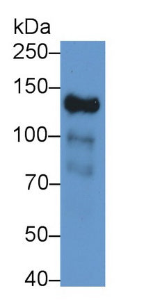 Angiomotin (AMOT) Polyclonal Antibody - image 2