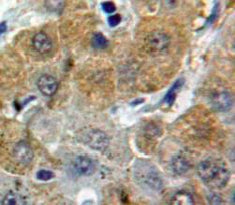Western Blot; Sample: Recombinant AFM, Human.