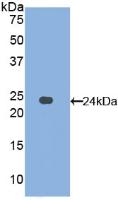 Western Blot; Sample: Human Serum.