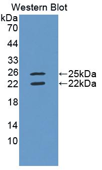 Interferon Gamma (IFNg) Polyclonal Antibody - image 3
