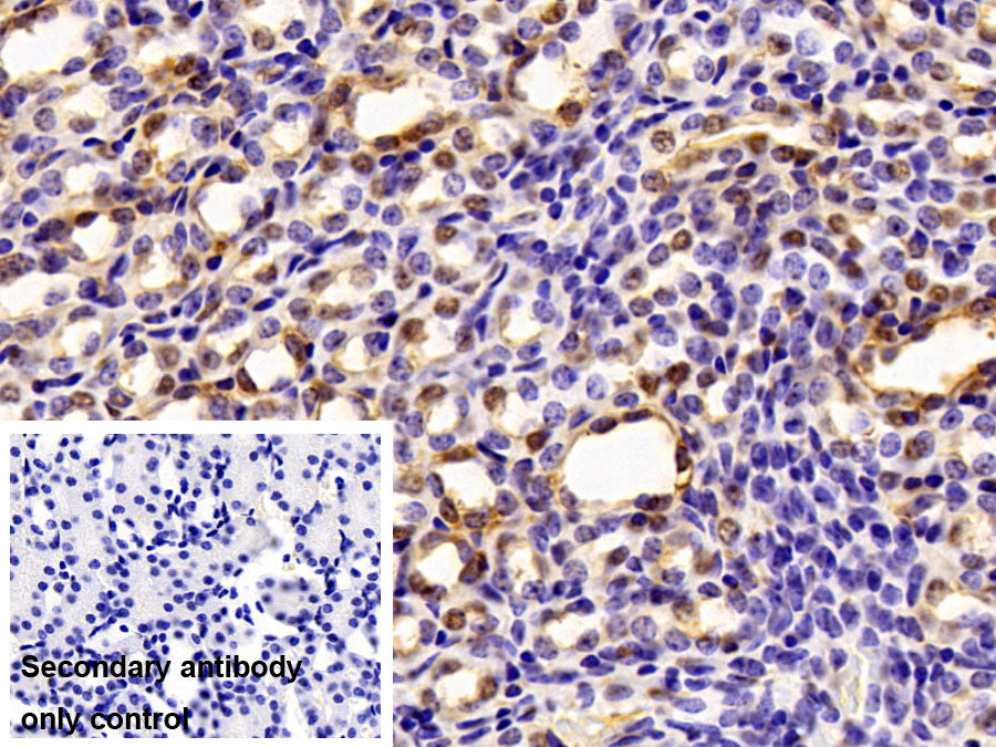DAB staining on IHC-P; Sample: Mouse Colon Tissue; Primary Ab: 10ug/ml Rabbit Anti-Mouse SUMO2 Antibody; Control: Used PBS instead of primary antibody; Second Ab: 2ug/ml HRP-Linked Caprine Anti-Rabbit IgG Polyclonal Antibody