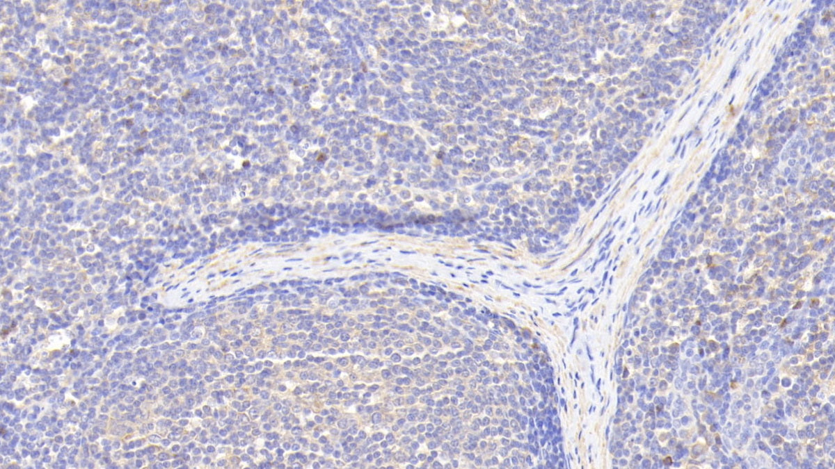 Western Blot; Sample: Lane1: Human Placenta lysate; Lane2: Mouse Ovary lysate; Lane3: Hela cell lysate Primary Ab: 3ug/ml Rabbit Anti-Human INHA Antibody Second Ab: 0.2ug/mL HRP-Linked Caprine Anti-Rabbit IgG Polyclonal Antibody