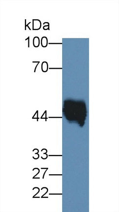 Western Blot; Sample: Lane1: Rat Lung lysate; Lane2: Rat Skin lysate; Primary Ab: 3ug/ml Mouse Anti-Human ELN Antibody; Second Ab: 0.2ug/mL HRP-Linked Rabbit Anti-Mouse IgG Polyclonal Antibody