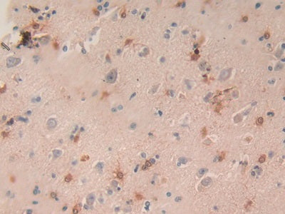 Macrophage Inflammatory Protein 3 Alpha (MIP3a) Monoclonal Antibody - image 2
