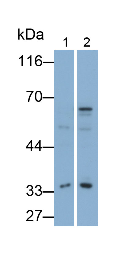 Galectin 3 (GAL3) Monoclonal Antibody - image 3