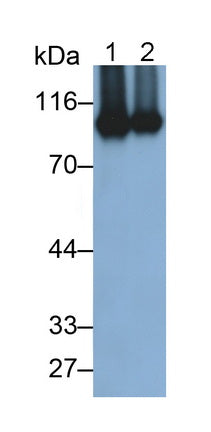 Matrix Metalloproteinase 9 (MMP9) Monoclonal Antibody - image 2