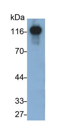Western Blot; Sample: A549 cell lysate; Primary Ab: 0.2ug/ml Mouse Anti-Human CDH5 Antibody; Second Ab: 0.2ug/ml HRP-Linked Caprine Anti-Mouse IgG Polyclonal Antibody