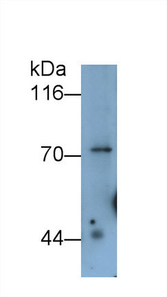 Cadherin 5 (CDH5) Monoclonal Antibody - image 3