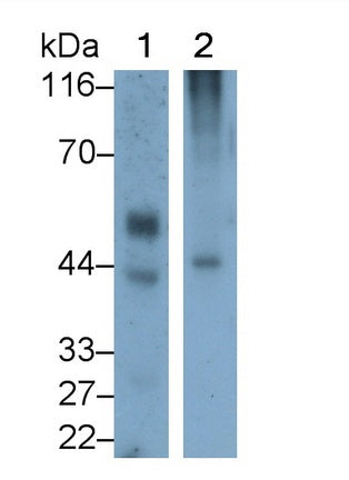 Kisspeptin Receptor (KISS1R) Monoclonal Antibody - image 2