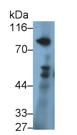 Nexilin (NEXN) Monoclonal Antibody - image 2