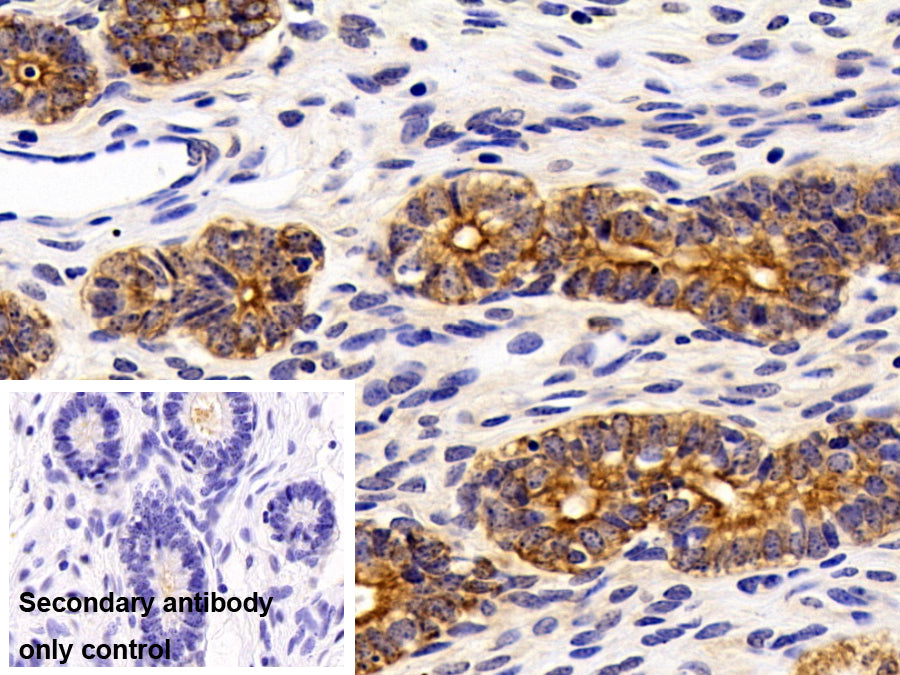 DAB staining on IHC-P; Sample: Porcine Small intestine Tissue; Primary Ab: 10ug/ml Rabbit Anti-Human CK19 Antibody; Control: Used PBS instead of primary antibody; Second Ab: 2ug/ml HRP-Linked Caprine Anti-Rabbit IgG Polyclonal Antibody