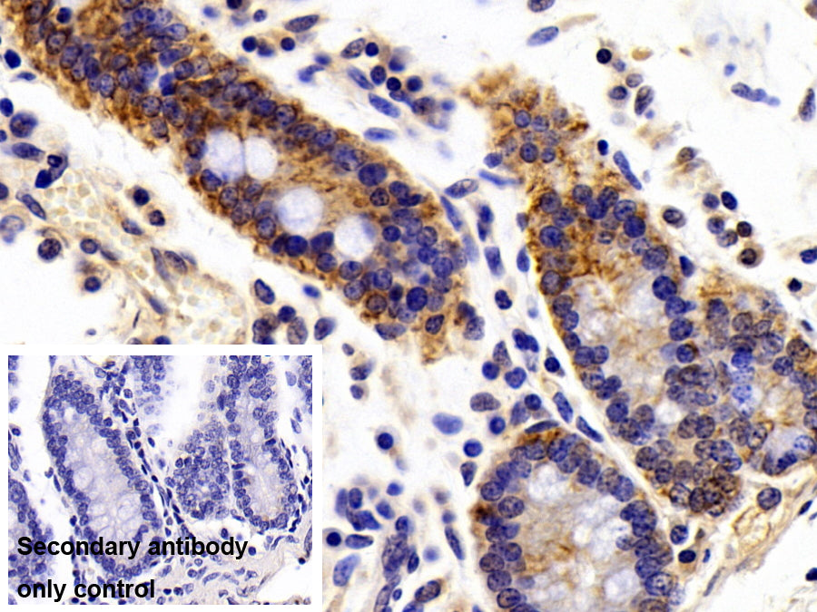 DAB staining on IHC-P; Sample: Porcine Pancreas Tissue; Primary Ab: 10ug/ml Rabbit Anti-Human CK19 Antibody; Control: Used PBS instead of primary antibody; Second Ab: 2ug/ml HRP-Linked Caprine Anti-Rabbit IgG Polyclonal Antibody