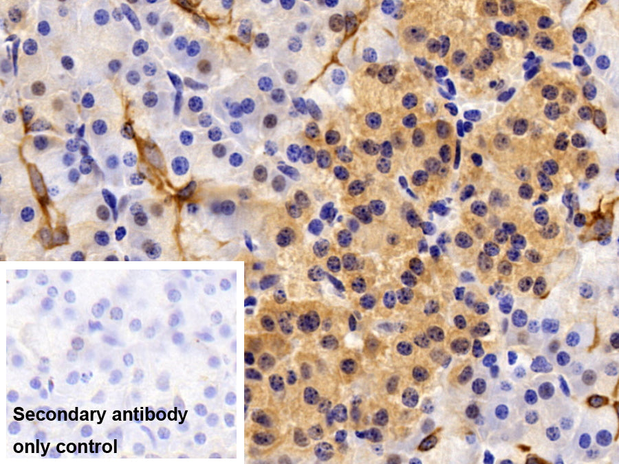 DAB staining on IHC-P; Sample: Porcine Liver Tissue; Primary Ab: 10ug/ml Rabbit Anti-Human CK19 Antibody; Control: Used PBS instead of primary antibody; Second Ab: 2ug/ml HRP-Linked Caprine Anti-Rabbit IgG Polyclonal Antibody