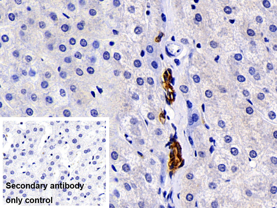 Cytokeratin 19 (CK19) Polyclonal Antibody - image 5