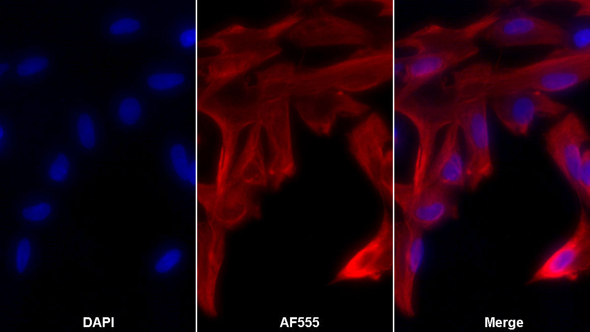 Glial Fibrillary Acidic Protein (GFAP) Monoclonal Antibody - image 2