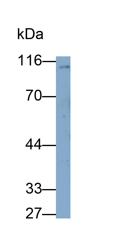 Ectonucleotide Pyrophosphatase/Phosphodiesterase 2 (ENPP2) Monoclonal Antibody - image 2