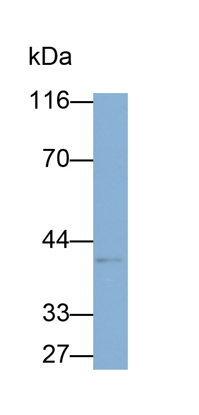 Melanoma Antigen Family B1 (MAGEB1) Polyclonal Antibody - image 2