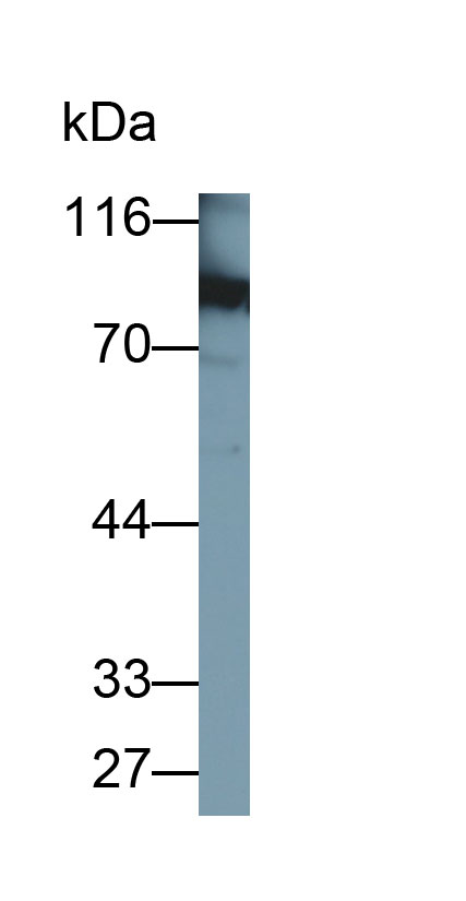 Prothrombin Fragment 1+2 (F1+2) Polyclonal Antibody - image 2