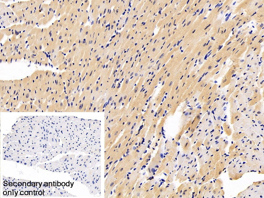 Natriuretic Peptide Precursor B (NPPB) Monoclonal Antibody - image 2