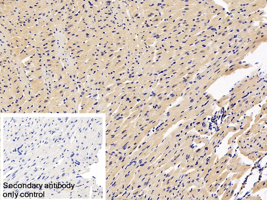 Natriuretic Peptide Precursor B (NPPB) Monoclonal Antibody - image 2