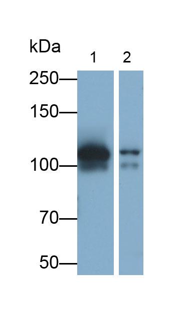 Cadherin 5 (CDH5) Monoclonal Antibody - image 2