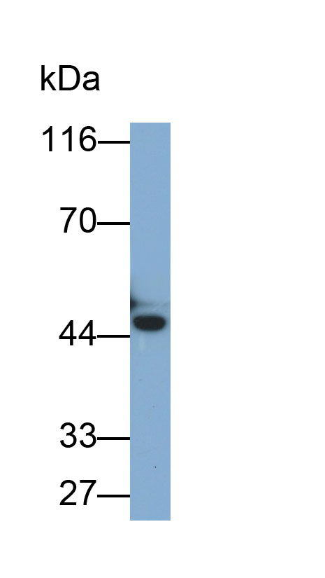 Cytokeratin Fragment Antigen 21-1 (CYFRA21-1) Monoclonal Antibody - image 2