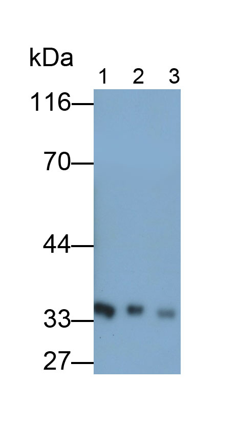 Growth Hormone Receptor (GHR) Monoclonal Antibody - image 2