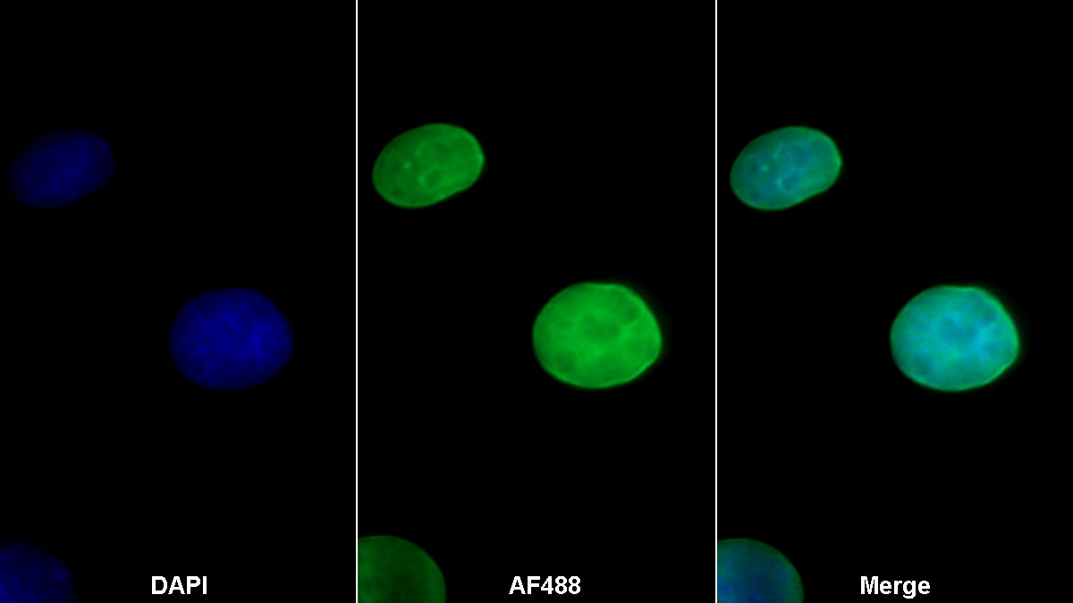 Western Blot; Sample: Hela cell lysate Primary Ab: 0.2ug/ml Mouse Anti-Human ERb Antibody Second Ab: 0.2ug/ml HRP-Linked Caprine Anti-Mouse IgG Polyclonal Antibody