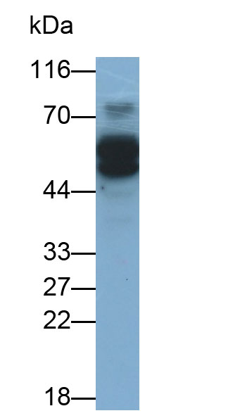 Estrogen Receptor Beta (ERb) Monoclonal Antibody - image 3
