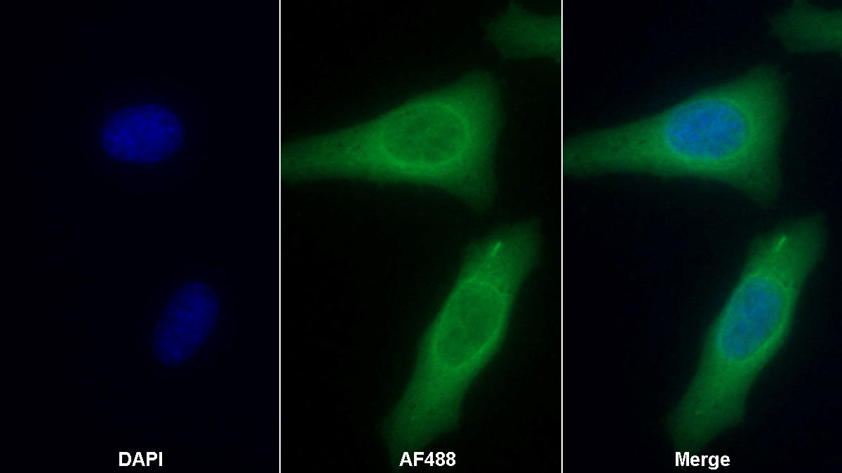 Plastin 3 (PLS3) Monoclonal Antibody - image 2