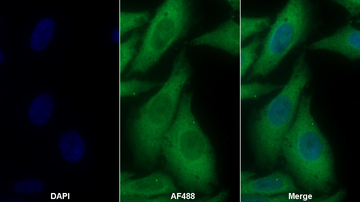 Plasmin/Antiplasmin Complex (PAP) Monoclonal Antibody - image 2