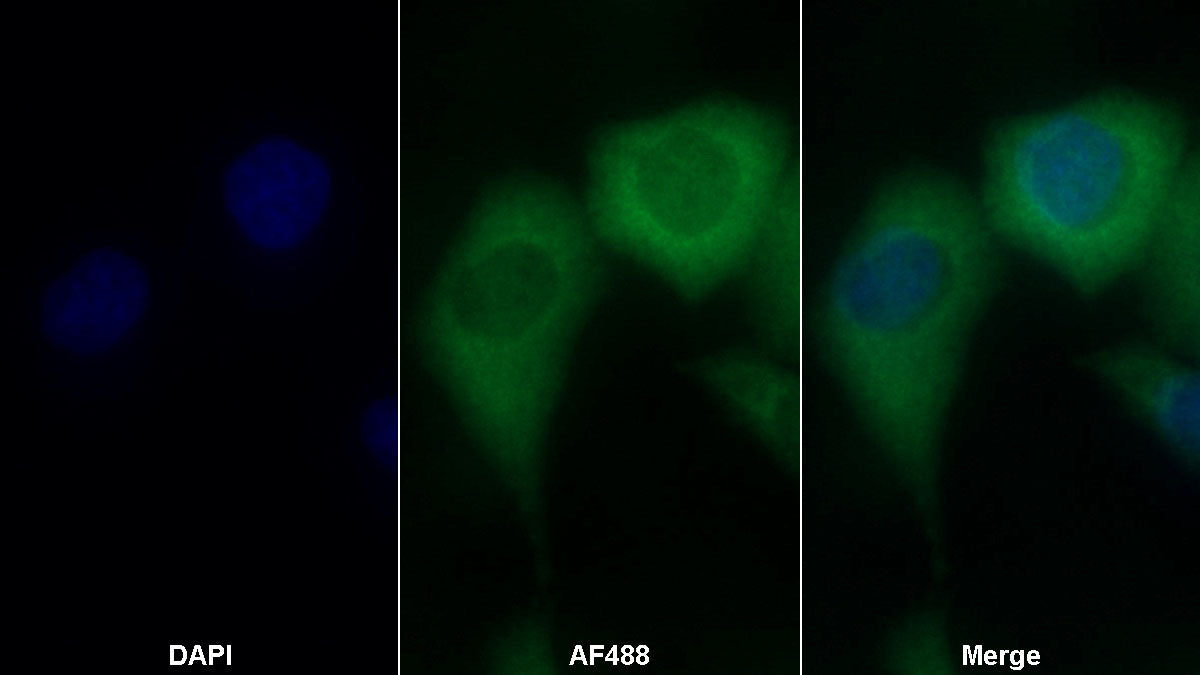 Insulin Receptor (INSR) Monoclonal Antibody - image 2