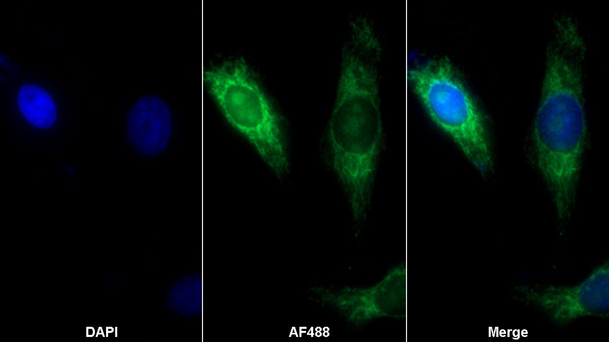 Acyl Coenzyme A Dehydrogenase, Short/Very Long Chain (ACADVL) Polyclonal Antibody - image 2