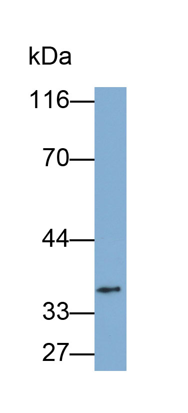 Cluster of Differentiation 79B (CD79B) Monoclonal Antibody - image 2