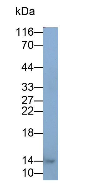 Heart-type Fatty Acid Binding Protein (H-FABP) Monoclonal Antibody - image 3