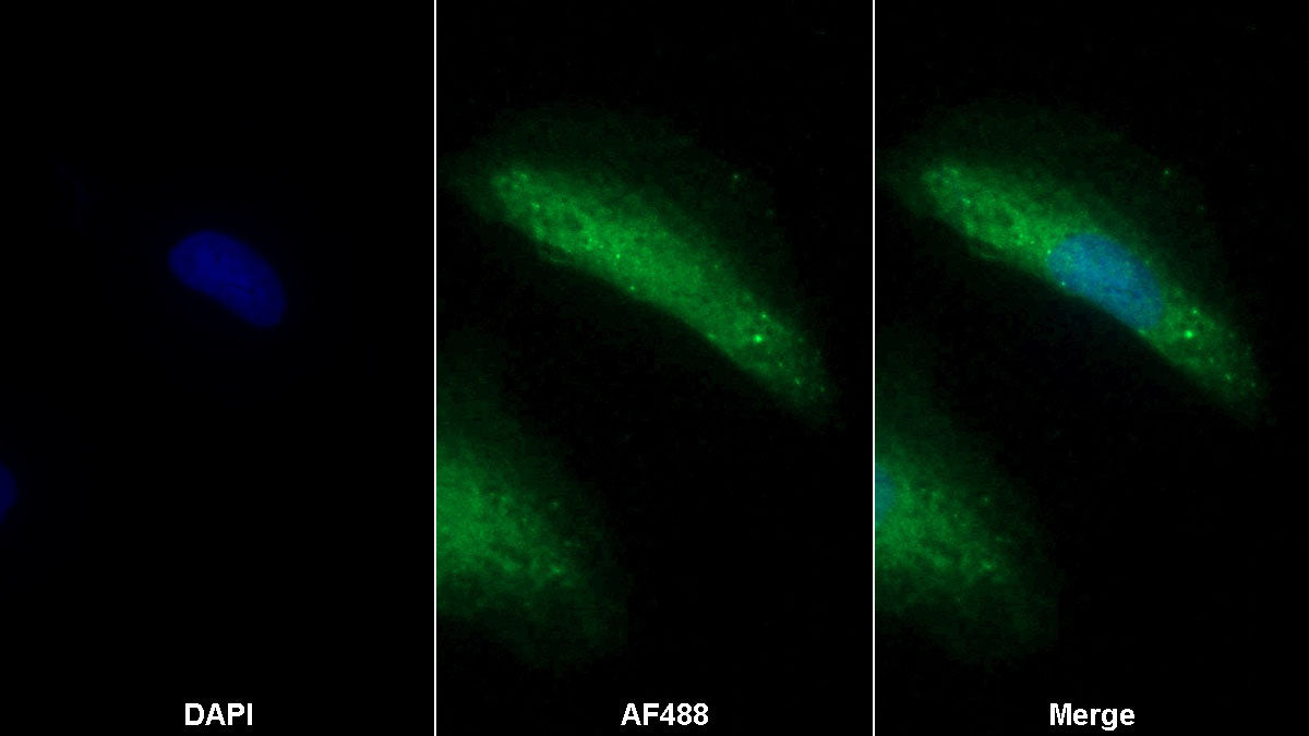 C-Type Lectin Domain Family 4, Member K (CLEC4K) Monoclonal Antibody - image 2