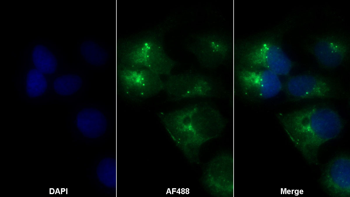 Transforming Growth Factor Beta 1 (TGFb1) Monoclonal Antibody - image 2