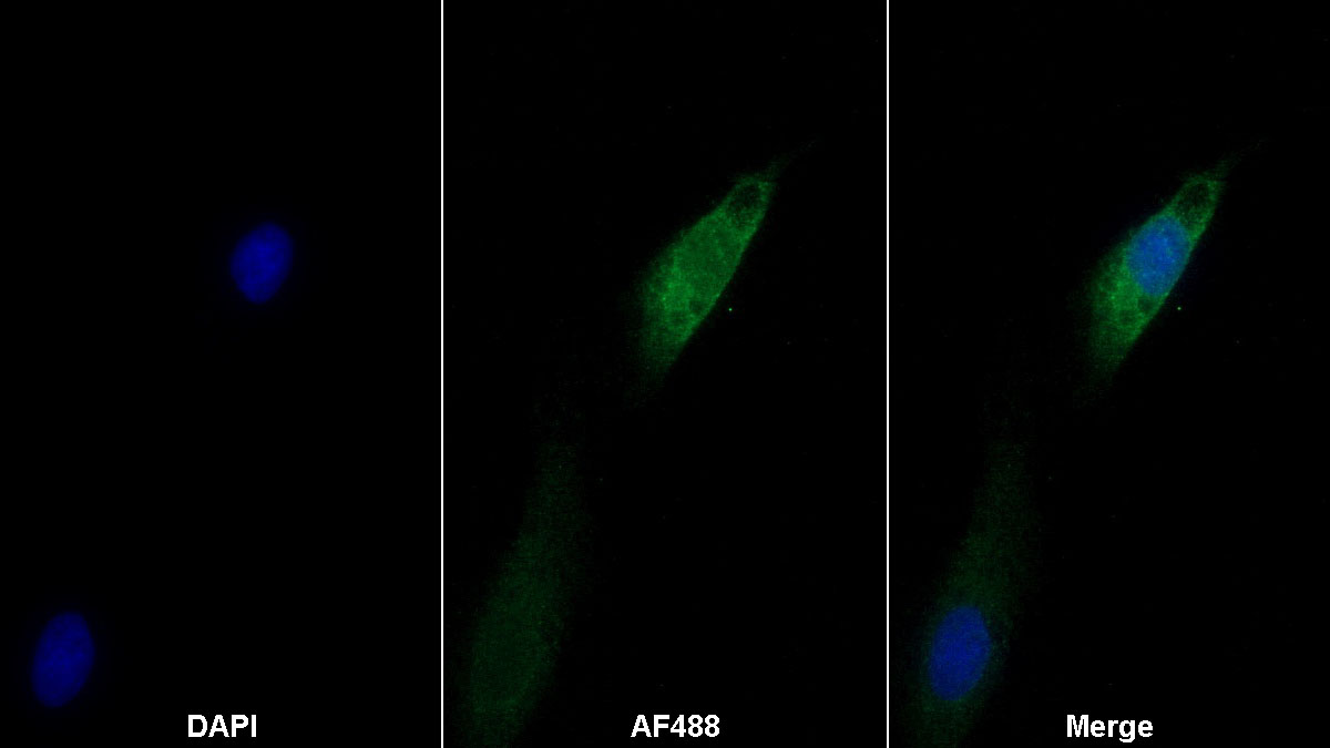 Interleukin 6 (IL6) Monoclonal Antibody - image 2