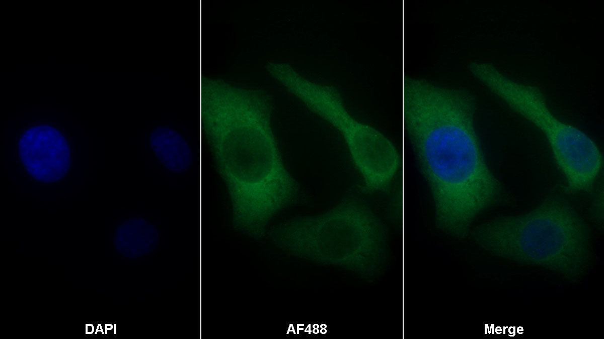 Caspase 6 (CASP6) Monoclonal Antibody - image 2